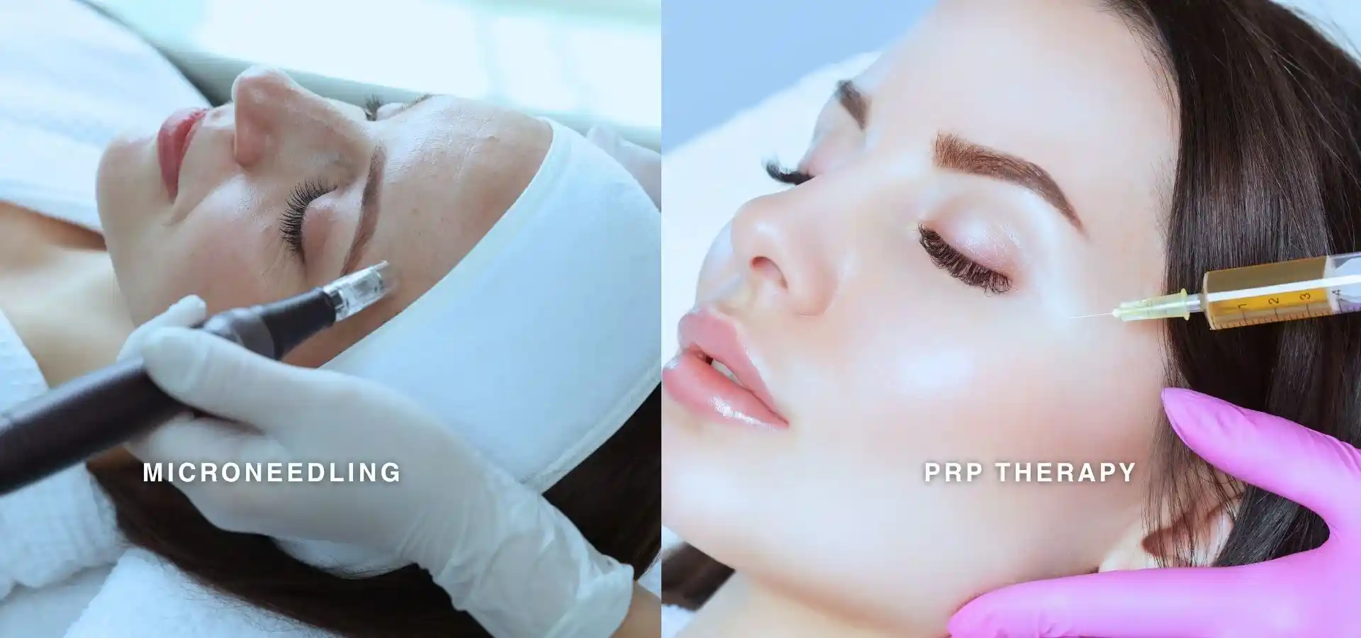 A split image showing two facial treatments: on the left, a woman receiving microneedling on her forehead, and on the right, a woman undergoing PRP therapy with a syringe near her cheek, both performed by professionals wearing gloves.