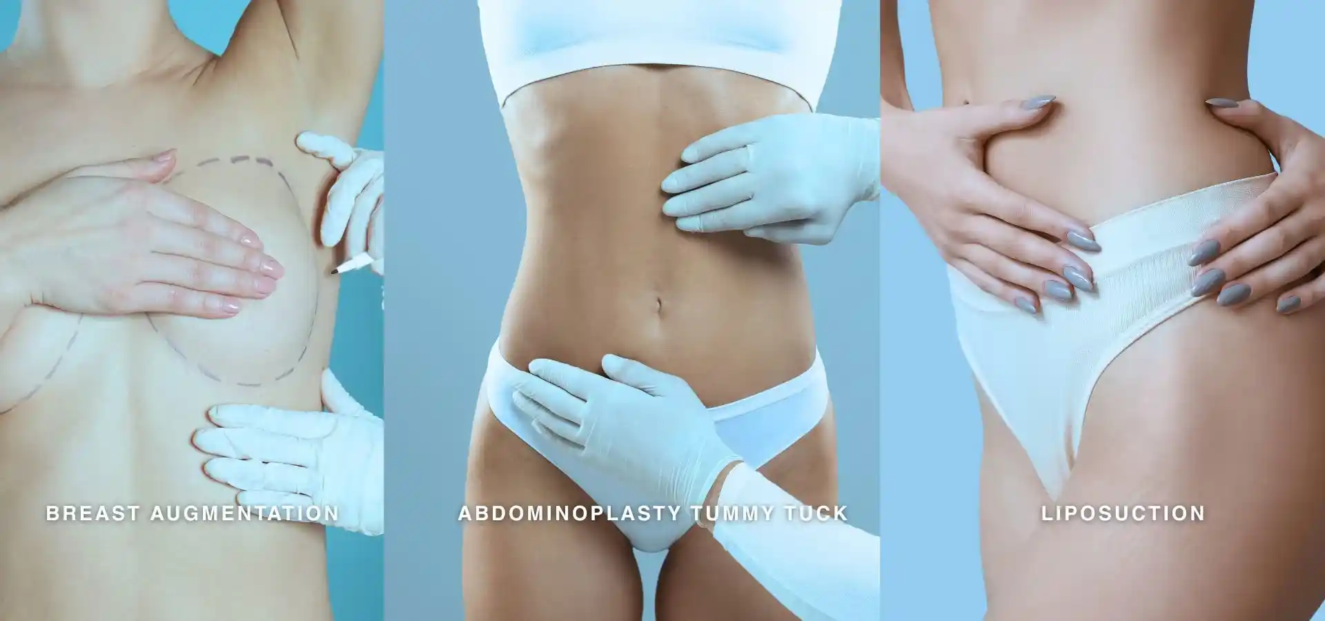 Three-panel cosmetic surgery image showing breast augmentation planning, abdominoplasty (tummy tuck) assessment, and liposuction results, highlighting common body contouring procedures.