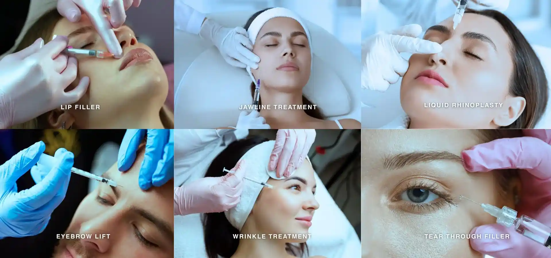 Collage of non-surgical cosmetic treatments showing lip filler, jawline contouring, liquid rhinoplasty, eyebrow lift, wrinkle treatment, and tear trough filler procedures performed with injectable treatments.