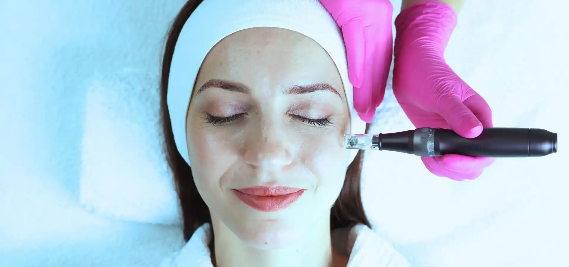 A woman with a headband lies with her eyes closed while receiving microneedling on her face from a professional wearing pink gloves.