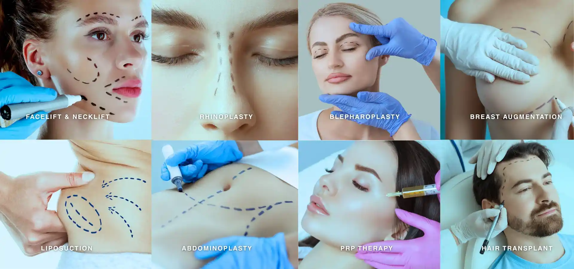 Collage of cosmetic and aesthetic procedures, including facelift and neck lift, rhinoplasty, blepharoplasty, breast augmentation, liposuction, abdominoplasty, PRP therapy, and hair transplant treatments.