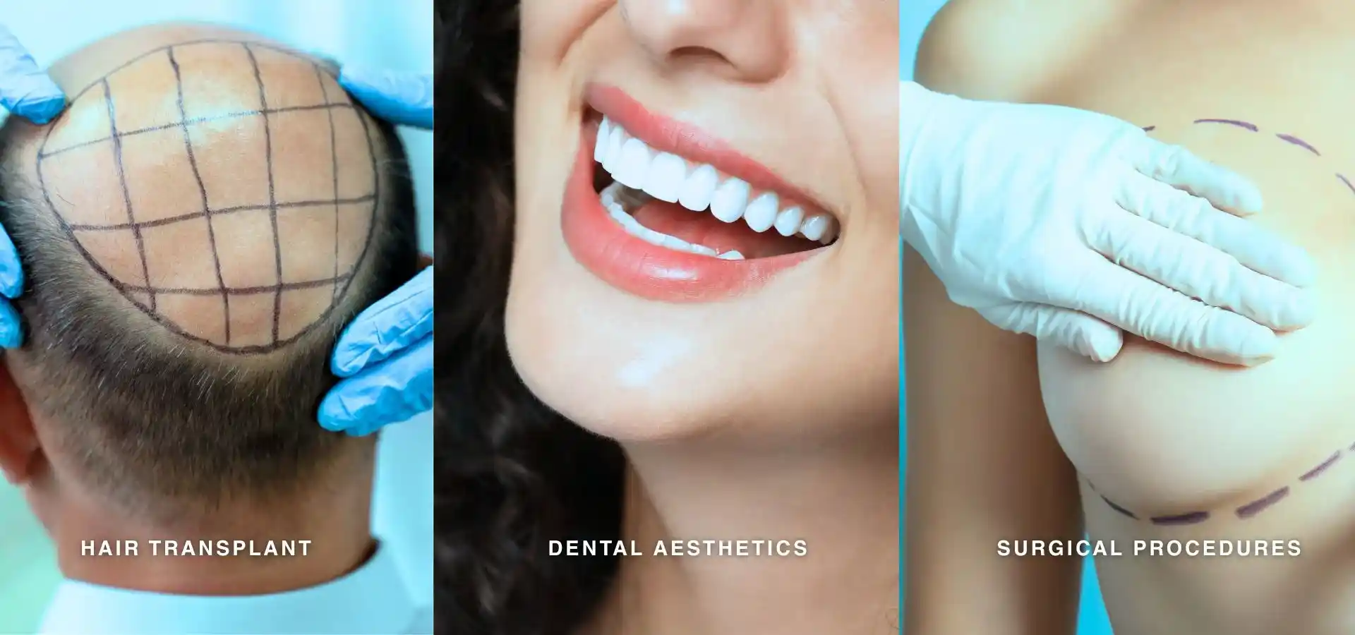 Three-panel medical aesthetics image featuring a hair transplant scalp mapping procedure, cosmetic dental treatment showcasing a bright smile, and a surgical body contouring procedure with pre-operative markings.